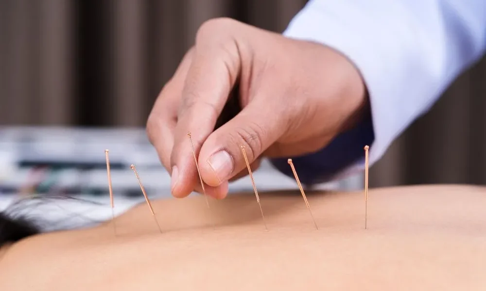Is-Acupuncture-Safe
