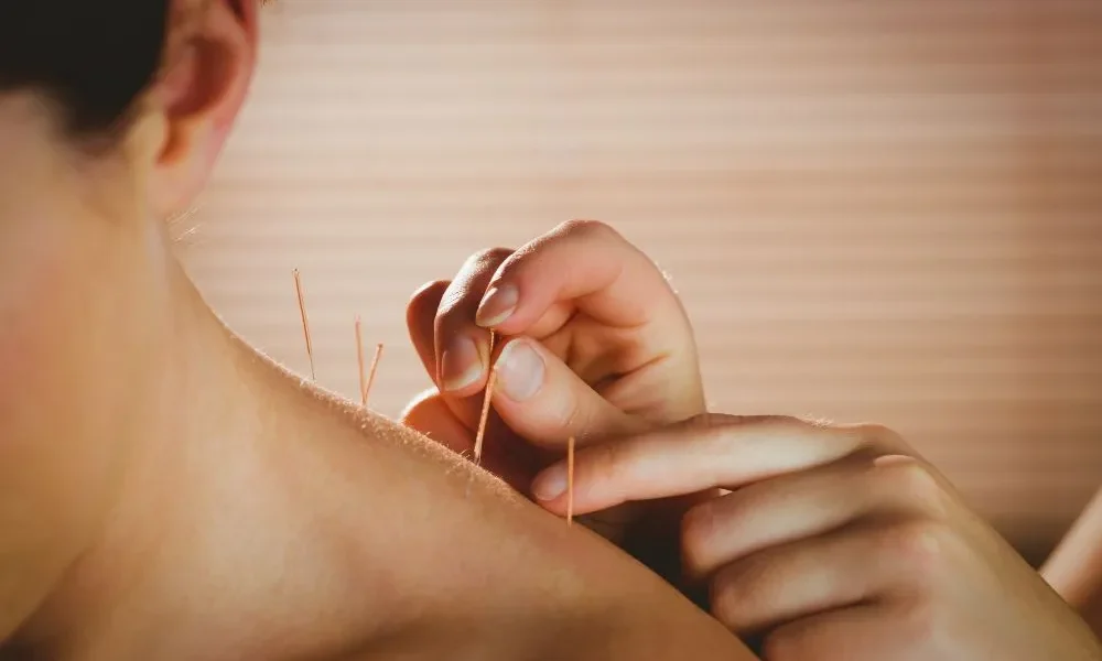 What Happens During Your First Acupuncture Session