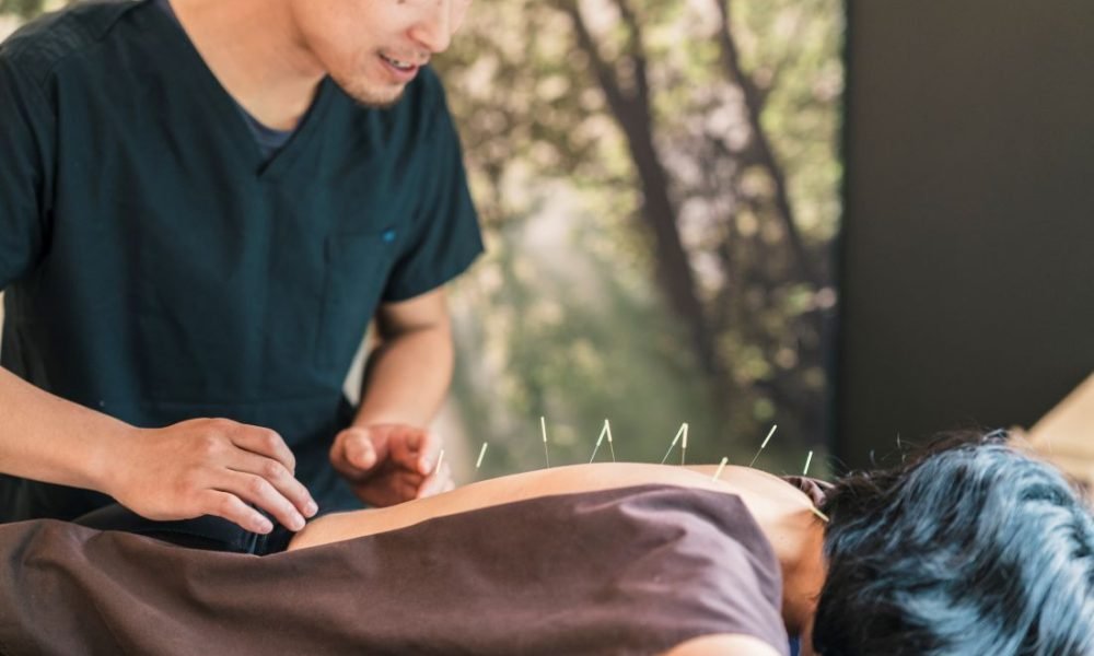 acupuncture-treatment